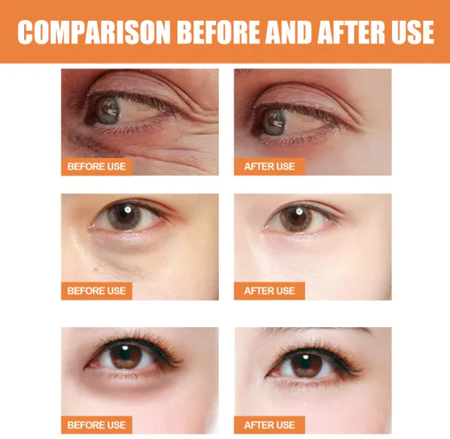 Bright Eyes Vitamin C Stick